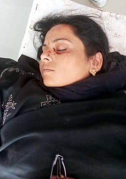 खुटार सीएचसी पर शरीफउल्ला का इलाज करते स्वास्थ्यकर्मी। संवाद