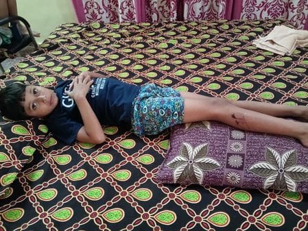 फोटो 27: सोनीपत के अशोक विहार में कुत्ते के काटे जाने से घायल हुए वेंकटेश्वर। स्रोत: पाठक फोटो 27: सोनीपत के अशोक विहार में कुत्ते के काटे जाने से घायल हुए वेंकटेश्वर। स्रोत: पाठक