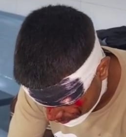 बनत के सामने बाइपास पर हादसे के बाद घायलों को अस्पताल लेकर जाते लोग। वीडियोग्रेब बनत के सामने बाइपास पर हादसे के बाद घायलों को अस्पताल लेकर जाते लोग। वीडियोग्रेब