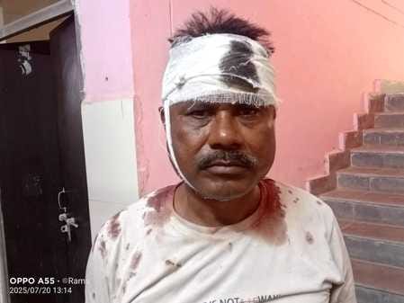जख्मी मुन्ना लाल। जख्मी मुन्ना लाल।