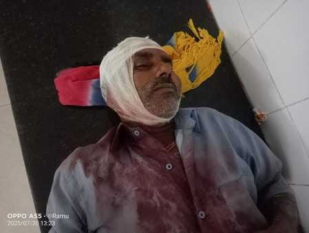 जख्मी मुन्ना लाल। जख्मी मुन्ना लाल।