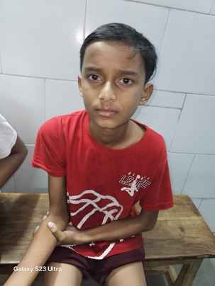 साँप के काटने से घायल मासूम