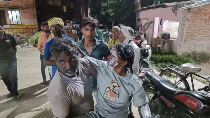 टेंगरिहा राजा गांव में गैस रिसाव से आग लगने से झुलसे बच्चे को लेकर अस्पताल पहुंचे परिजन। टेंगरिहा राजा गांव में गैस रिसाव से आग लगने से झुलसे बच्चे को लेकर अस्पताल पहुंचे परिजन।