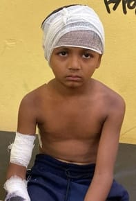 नहटौर के गांव चौहरा में कुत्तों के हमले में घायल महिला प्रियंका। संवाद नहटौर के गांव चौहरा में कुत्तों के हमले में घायल महिला प्रियंका। संवाद