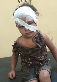 नहटौर के गांव चौहरा में कुत्तों के हमले में घायल महिला प्रियंका। संवाद नहटौर के गांव चौहरा में कुत्तों के हमले में घायल महिला प्रियंका। संवाद