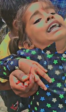 शहर में आवारा कुत्ते ने बच्ची के हाथ पर काटा। वीडियो ग्रैब