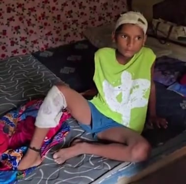 134 ....कुत्ते के काटने के बाद जख्मी बेटे अनमोल को दिखाते माता-पिता। संवाद