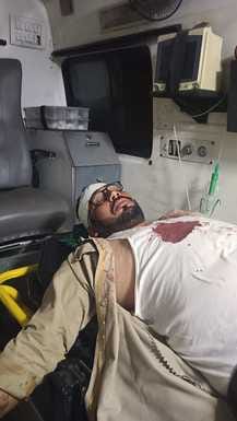 अंबाला कैंट स्टैंड पर हुए हमले में घायल पंजाब रोडवेज बस का ड्राइवर विकास: स्वयंं अंबाला कैंट स्टैंड पर हुए हमले में घायल पंजाब रोडवेज बस का ड्राइवर विकास: स्वयंं