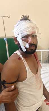 भावनपुर थाना के गांव लू बक्सर में तेज गाडी चलाने के विरोध मे दो पक्षो मे मारपीट में घायल ललिन भावनपुर थाना के गांव लू बक्सर में तेज गाडी चलाने के विरोध मे दो पक्षो मे मारपीट में घायल ललिन