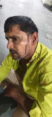 भावनपुर थाना के गांव लू बक्सर में तेज गाडी चलाने के विरोध मे दो पक्षो मे मारपीट में घायल ललिन भावनपुर थाना के गांव लू बक्सर में तेज गाडी चलाने के विरोध मे दो पक्षो मे मारपीट में घायल ललिन