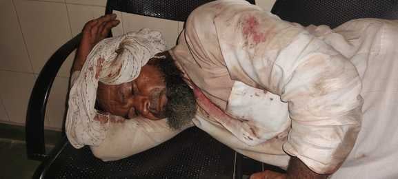 भावनपुर थाना के गांव लू बक्सर में तेज गाडी चलाने के विरोध मे दो पक्षो मे मारपीट में घायल ललिन भावनपुर थाना के गांव लू बक्सर में तेज गाडी चलाने के विरोध मे दो पक्षो मे मारपीट में घायल ललिन