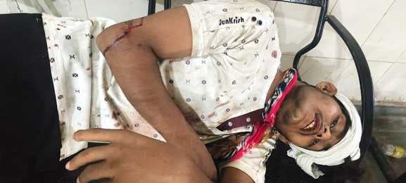भावनपुर थाना के गांव लू बक्सर में तेज गाडी चलाने के विरोध मे दो पक्षो मे मारपीट में घायल ललिन भावनपुर थाना के गांव लू बक्सर में तेज गाडी चलाने के विरोध मे दो पक्षो मे मारपीट में घायल ललिन