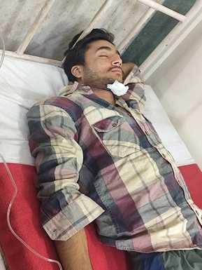 आसमानी बिजली गिरने से घायल युवक। स्त्रोत: जागरूक पाठक आसमानी बिजली गिरने से घायल युवक। स्त्रोत: जागरूक पाठक
