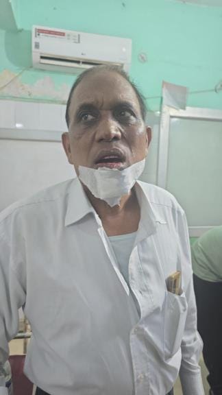 टैंकर से भिड़ी बस। टैंकर से भिड़ी बस।