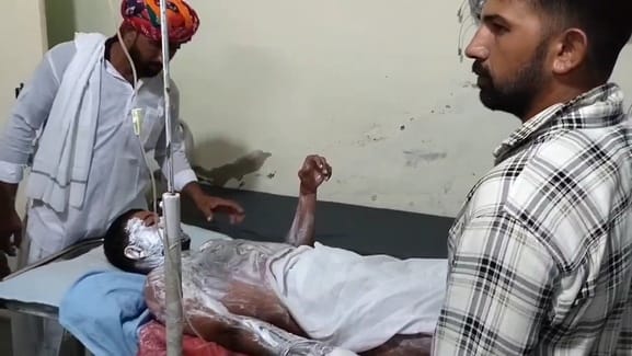 चित्तौड़गढ़ जिले के रावतभाटा में जुलूस के दौरान करंट से झुलसे ग्रामीणों को चिकित्सालय में उपचार