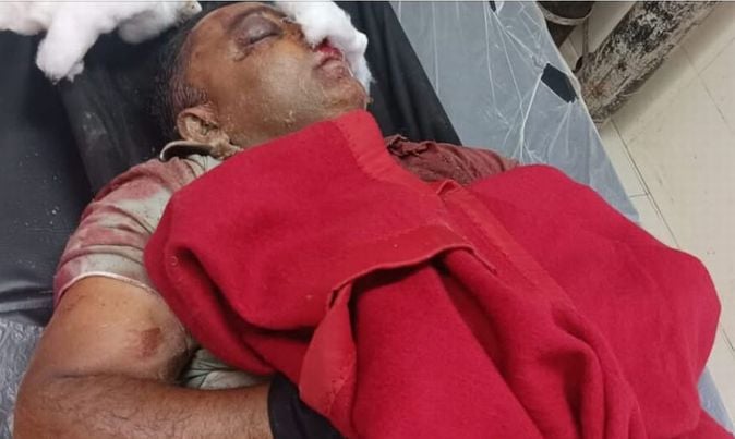 चंबा मे भारी बारिश के चलते बंद पड़ा अलवास-किलाड़ मार्ग।स्रोत जागरूक पाठक चंबा मे भारी बारिश के चलते बंद पड़ा अलवास-किलाड़ मार्ग।स्रोत जागरूक पाठक