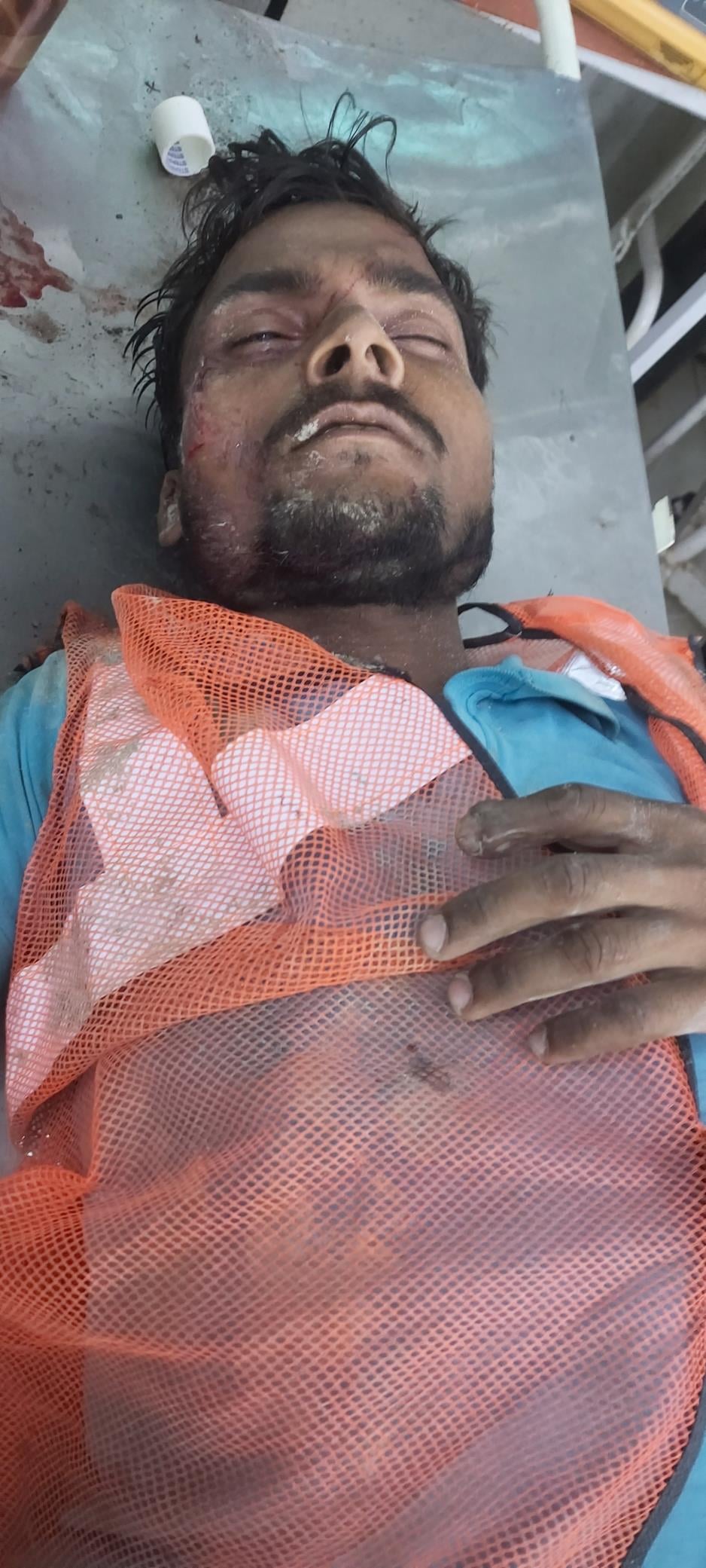 दीवार गिरने से मजदूर घायल।