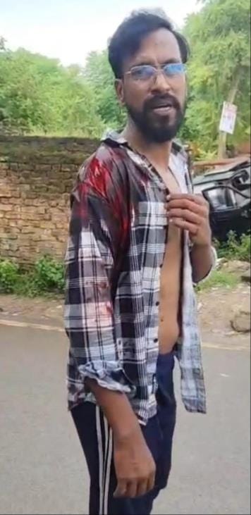घायल मो. आतिफ।