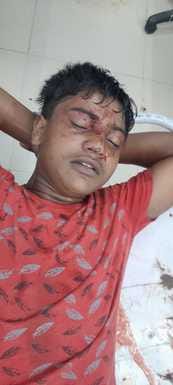 गांव खेडी मनिहार में युवक को गोली मारने का प्रयास करने वाला आरोपी भागते हुए। (स्त्रोत सोशल मीडि गांव खेडी मनिहार में युवक को गोली मारने का प्रयास करने वाला आरोपी भागते हुए। (स्त्रोत सोशल मीडि