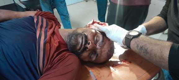 गांव खेडी मनिहार में युवक को गोली मारने का प्रयास करने वाला आरोपी भागते हुए। (स्त्रोत सोशल मीडि गांव खेडी मनिहार में युवक को गोली मारने का प्रयास करने वाला आरोपी भागते हुए। (स्त्रोत सोशल मीडि