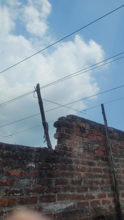 ट्रॉमा सेंटर में भर्ती झुलसी बच्ची। ट्रॉमा सेंटर में भर्ती झुलसी बच्ची।