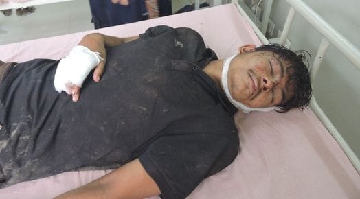 चोर समझ कर ग्रामीणों ने पीटा घायल.................................नवीन । चोर समझ कर ग्रामीणों ने पीटा घायल.................................नवीन ।