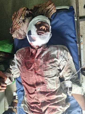 बाघ के हमले में घायल पिता रामचंद्र। संवाद