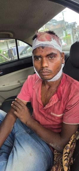 काकोरी के सकरा गांव में केशन के घर के बाहर बैठे ग्रामीण घटना के बारे में जानकारी लेते और घायल स काकोरी के सकरा गांव में केशन के घर के बाहर बैठे ग्रामीण घटना के बारे में जानकारी लेते और घायल स