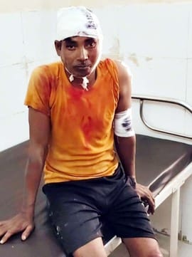 खुटार के गांव रायपुर पटियात के पास तेदुए के हमले में युवक के घायल होने पर जानकारी लेते रेंजर। स खुटार के गांव रायपुर पटियात के पास तेदुए के हमले में युवक के घायल होने पर जानकारी लेते रेंजर। स