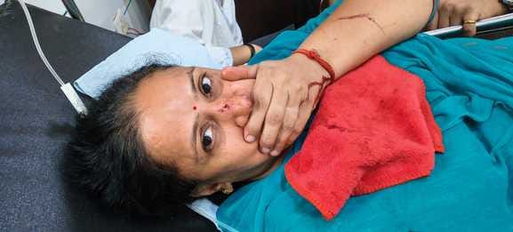 दौराला- हाईवे पर दुर्घटना के बाद क्षतिग्रस्त बस। स्रोत : संवाद दौराला- हाईवे पर दुर्घटना के बाद क्षतिग्रस्त बस। स्रोत : संवाद