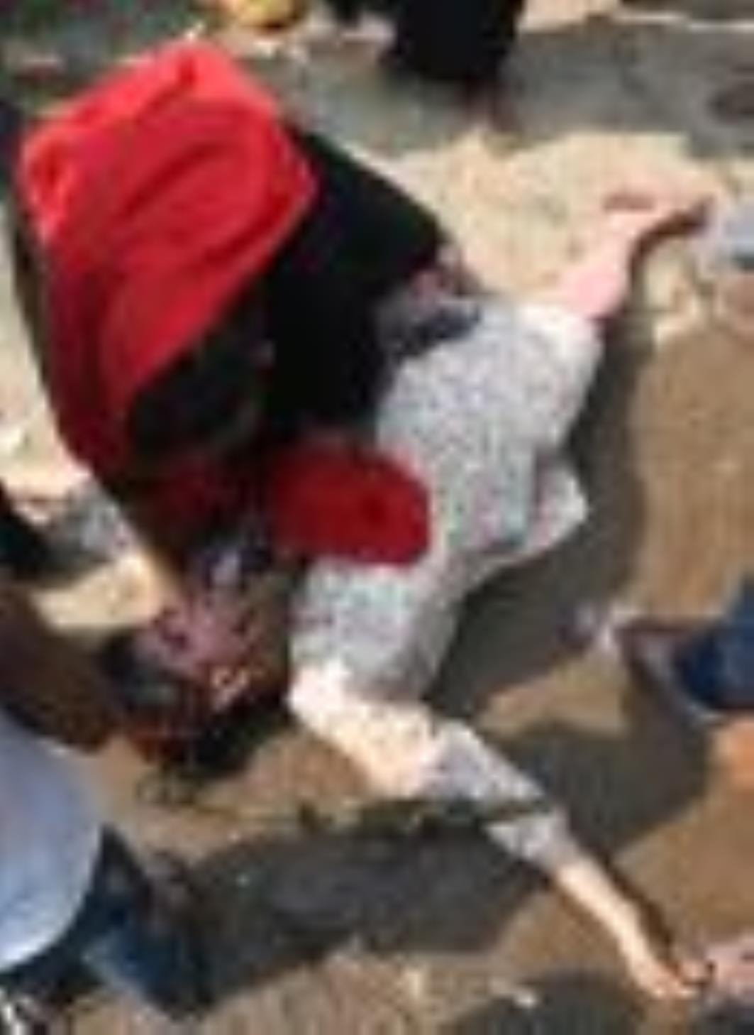 केजीएमयू ने हटाया अतिक्रमण और घर टूटने से परेशान लोग। केजीएमयू ने हटाया अतिक्रमण और घर टूटने से परेशान लोग।