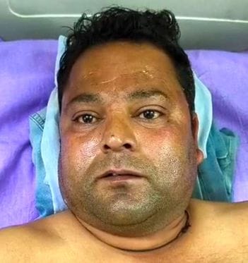 फोटो 13 एमएएचपी 04 परिचय-जिला अस्पताल में भर्ती करंट की चपेट में आने से झुलसे अधिकारी व कर्मचा