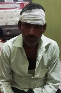सरधना। गांव अटेरना में मारपीट में घायल। संवाद सरधना। गांव अटेरना में मारपीट में घायल। संवाद