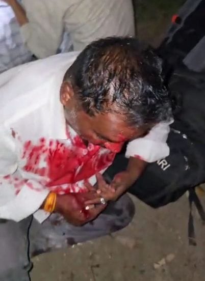 बस से घायल को पीठ पर लादकर निकालकर लाता युवक। संवाद