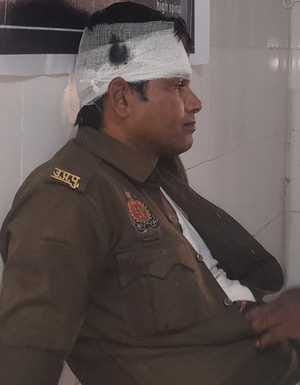 कुंदरकी में मुरादाबाद आगरा नेशनल हाईवे पर हादसे में गंभीर घायल हेड कांस्टेबल सुखनंदन गंगवार  सं