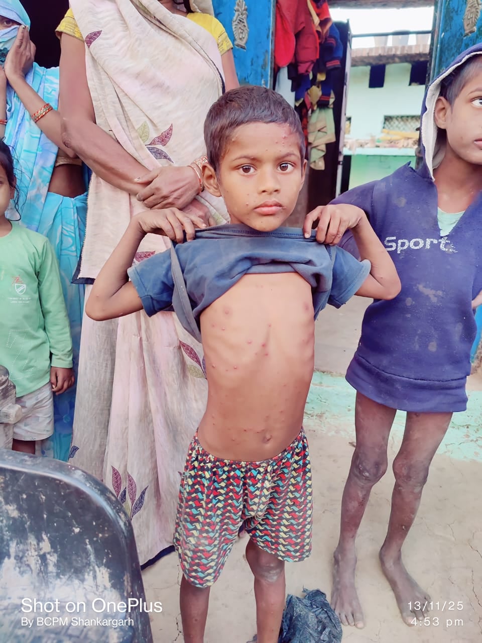 क्षेत्र के मदुरी गांव में संक्रमित लोगों की जांच पड़ताल करती हुई स्वास्थ्य विभाग की टीम क्षेत्र के मदुरी गांव में संक्रमित लोगों की जांच पड़ताल करती हुई स्वास्थ्य विभाग की टीम