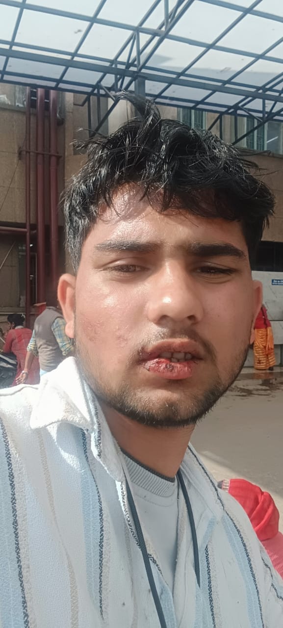 मारपीट में घायल लोग।