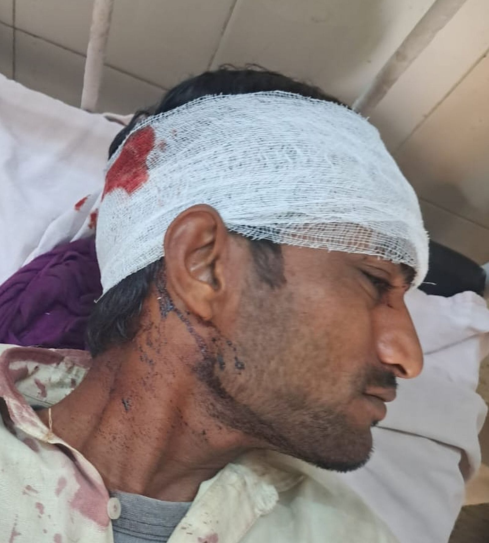 घायल रेनू। घायल रेनू।
