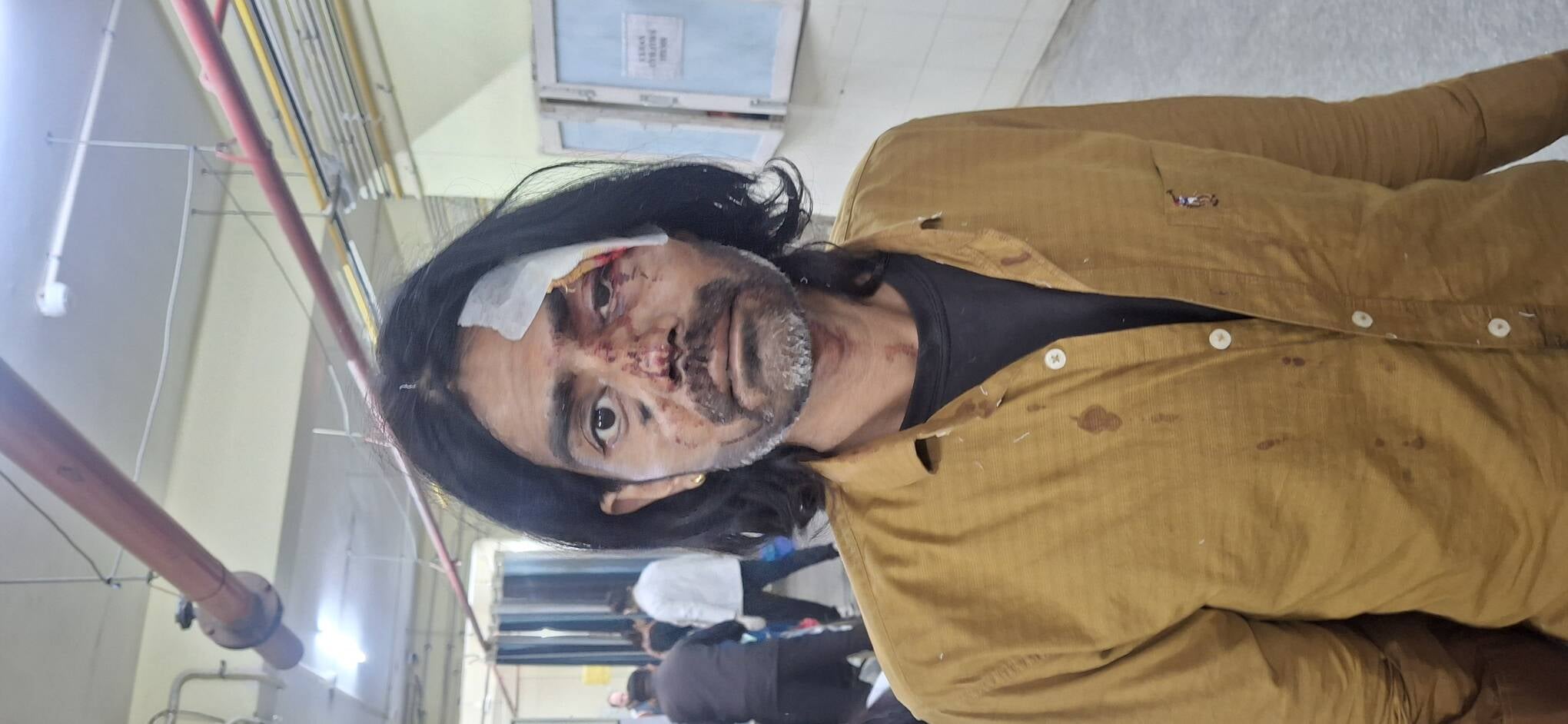 फोटो 65 : बस पलटने से घायल यात्री। संवाद फोटो 65 : बस पलटने से घायल यात्री। संवाद