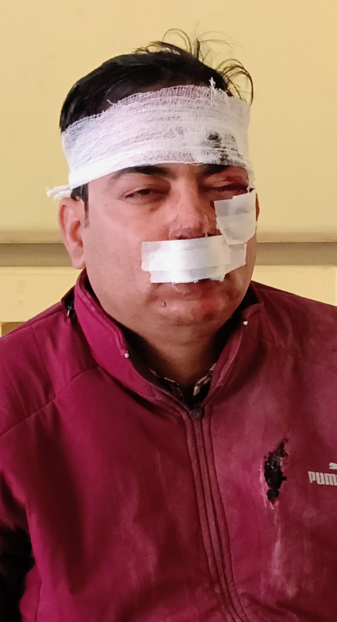 बाइक का टायर फटने से घायल बाइक सवार अशोक। (मवाना) बाइक का टायर फटने से घायल बाइक सवार अशोक। (मवाना)