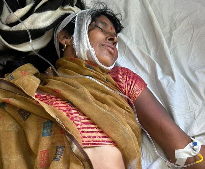 फोटो 28 एमएएचपी 14 परिचय-गोली लगने से घायल राम उर्फ देवेश द्विवेदी। संवाद