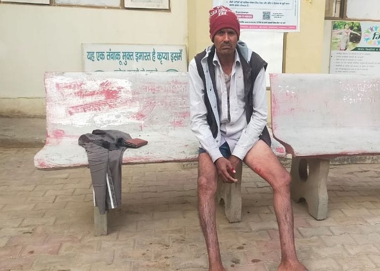 फोटो संख्या:-65 गांव चेलावास में कुत्ते के काटने से घायल व्यक्ति जख्म दिखाता---संवाद