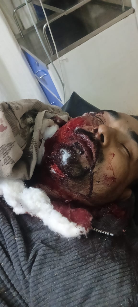 दुर्घटना में क्षतिग्रस्त कार जो बारातियों को लेकर लौट रही थी। (परीक्षितगढ) दुर्घटना में क्षतिग्रस्त कार जो बारातियों को लेकर लौट रही थी। (परीक्षितगढ)