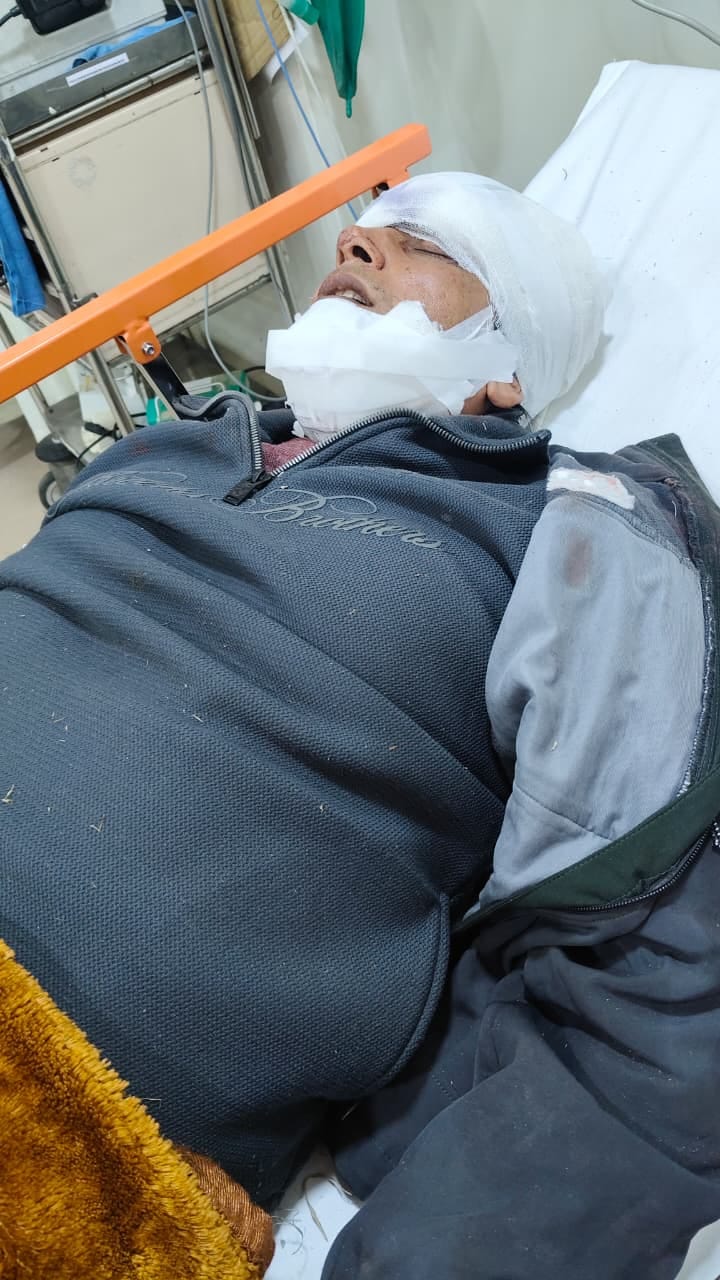 दुर्घटना में क्षतिग्रस्त कार जो बारातियों को लेकर लौट रही थी। (परीक्षितगढ) दुर्घटना में क्षतिग्रस्त कार जो बारातियों को लेकर लौट रही थी। (परीक्षितगढ)