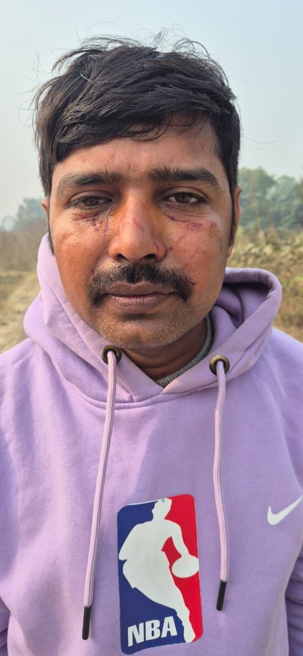 मारपीट में घायल सिपाही अर्चित चौहान और अंकित सिंह। मारपीट में घायल सिपाही अर्चित चौहान और अंकित सिंह।