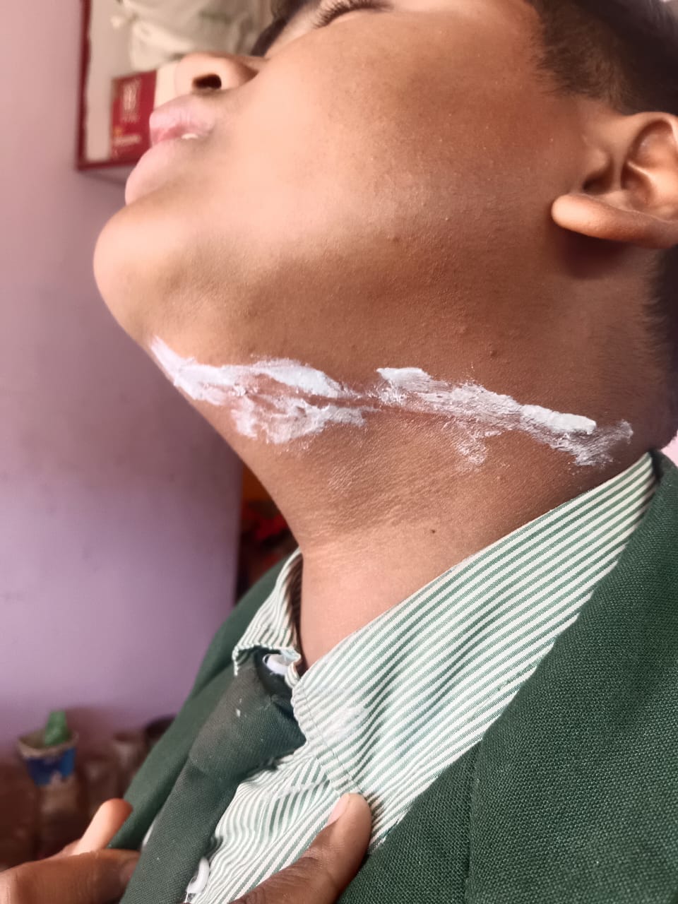 धार में फिर खतरा बना प्रतिबंधित चाइनीज मांझा, देवीजी मार्ग पर स्कूल जा रहे मासुम के गले में ल