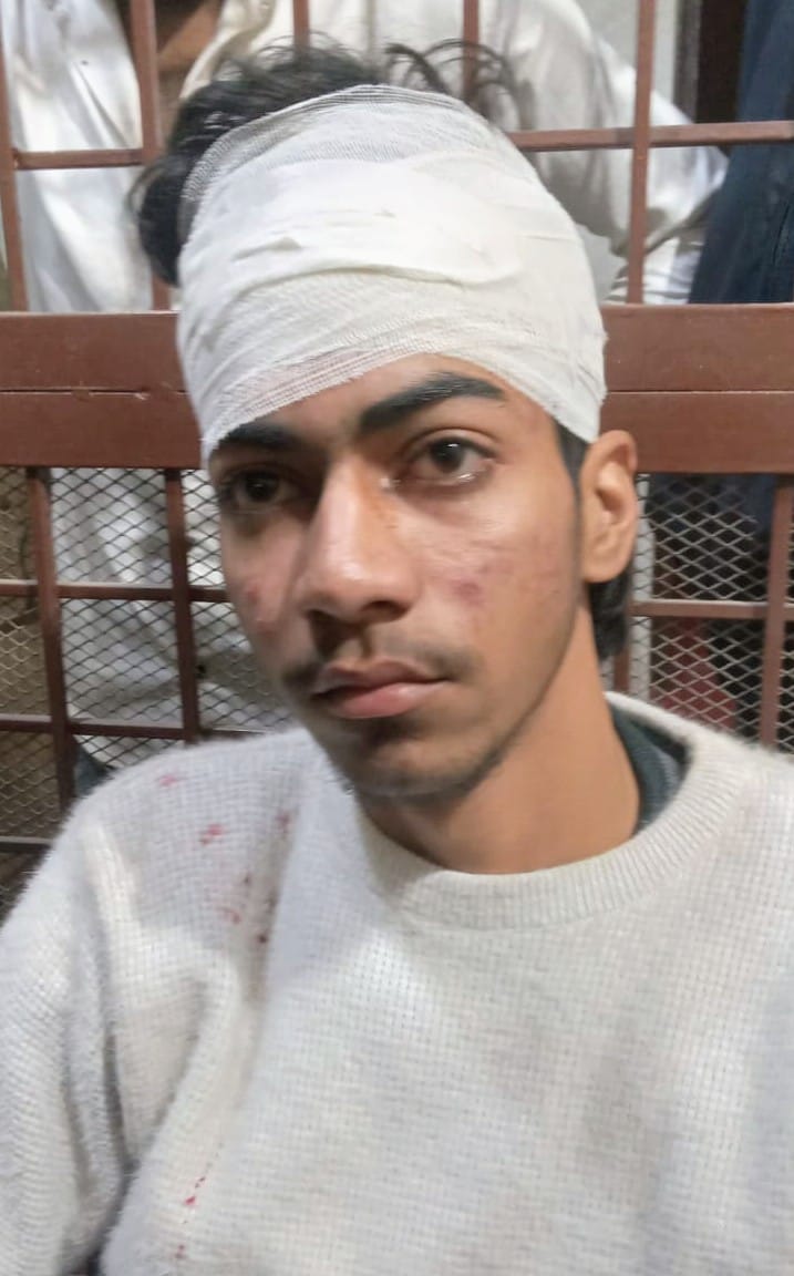 मारपीट में घायल मोहल्ला मुन्नालाल ठेली लगाने वाला मौ. उमर। (मवाना) मारपीट में घायल मोहल्ला मुन्नालाल ठेली लगाने वाला मौ. उमर। (मवाना)