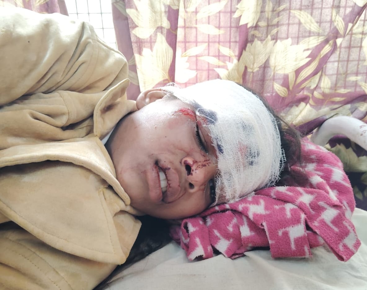 घायल दीपा घायल दीपा