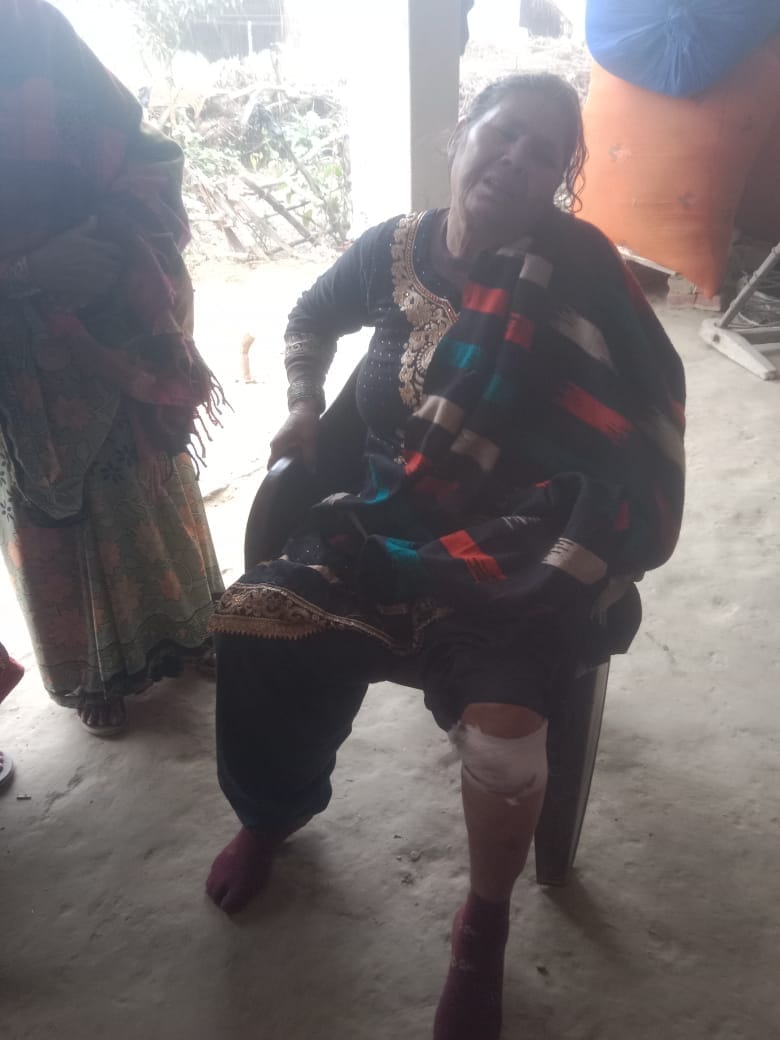 बस्ती में घायल बेलहर के वार्ड दो निवासी असरून्निशा के घर जुटी भीड़-संवाद बस्ती में घायल बेलहर के वार्ड दो निवासी असरून्निशा के घर जुटी भीड़-संवाद