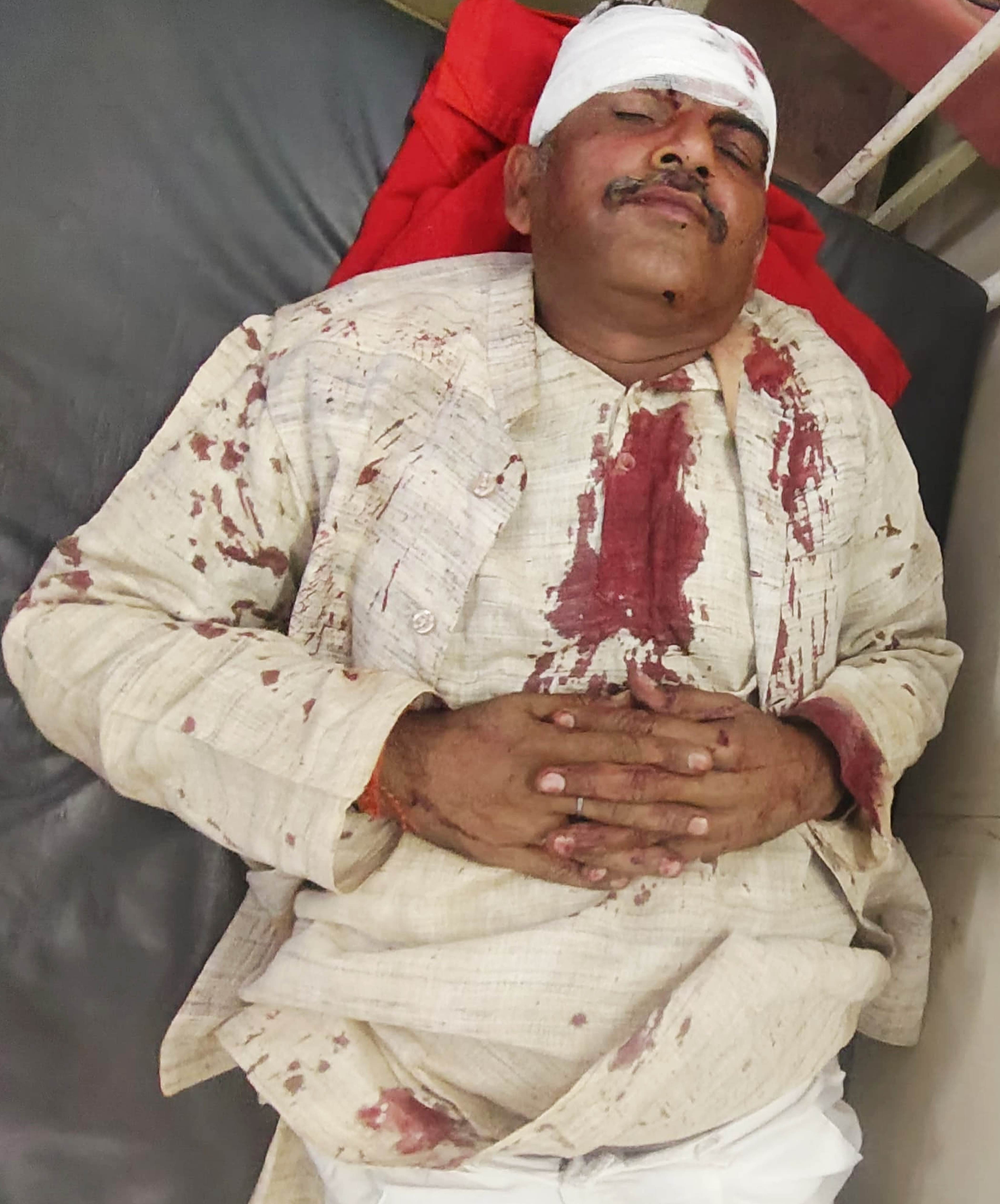 फोटो-28-जिला अस्पताल घायलों का हाल जानने से पहुंचे पूर्व ब्लॉक प्रमुख सुधीर त्रिपाठी। वीडियो ग् फोटो-28-जिला अस्पताल घायलों का हाल जानने से पहुंचे पूर्व ब्लॉक प्रमुख सुधीर त्रिपाठी। वीडियो ग्